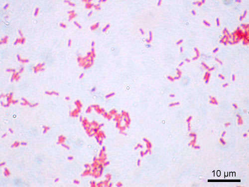 Escherichia coli - foto di Y_tambe